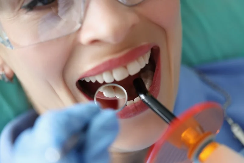 Blanqueamiento Dental